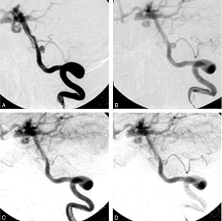 Fig 3.