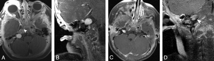 Fig 1.
