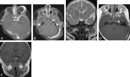 Fig 2.