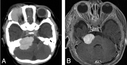 Fig 3.