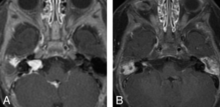 Fig 4.