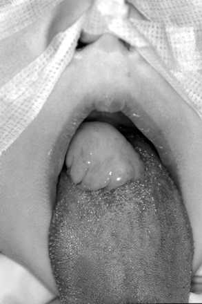 Fig 1.