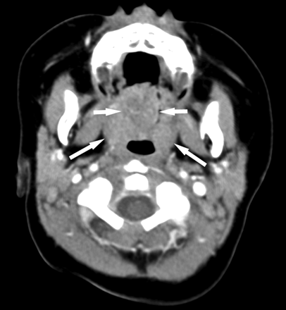 Fig 2.