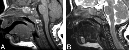 Fig 3.