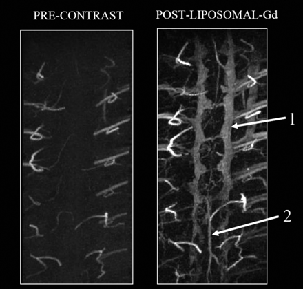 Fig 2.