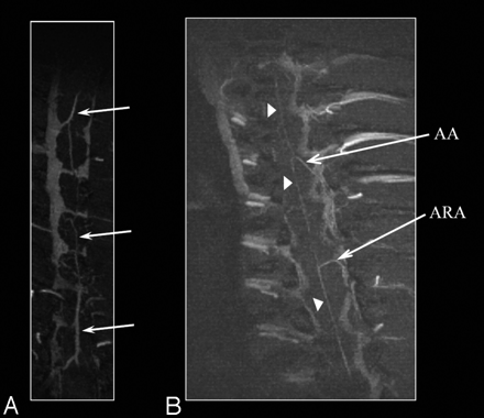 Fig 4.