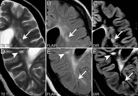 Fig 3.
