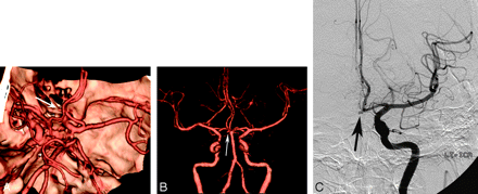 Fig 3.