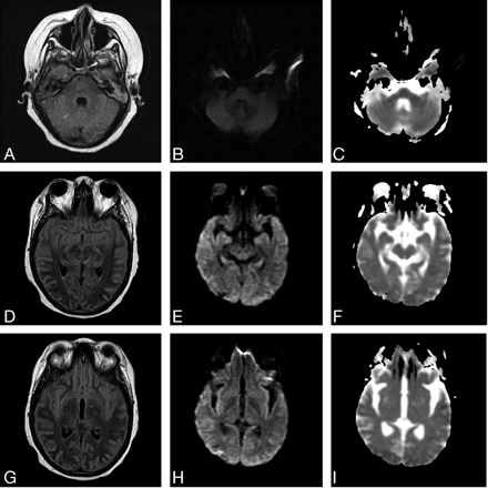 Fig 3.
