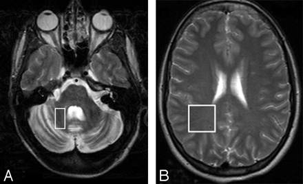 Fig 1.