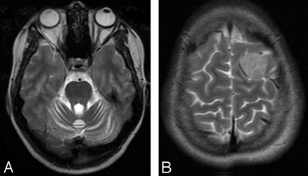 Fig 2.