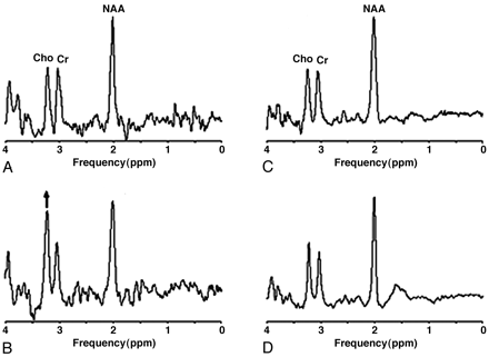 Fig 4.