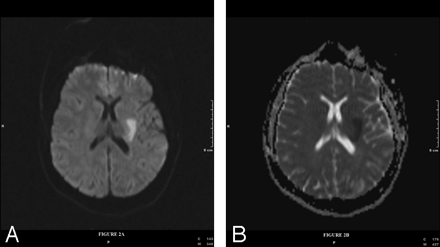 Fig 2.