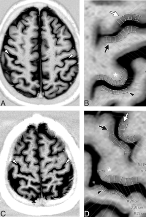 Fig 1.