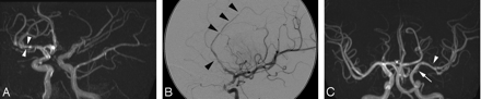 Fig 1.