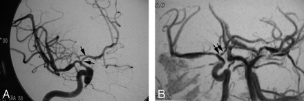 Fig 2.
