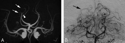 Fig 4.
