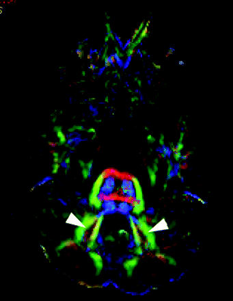 Fig 3.