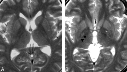 Fig 1.