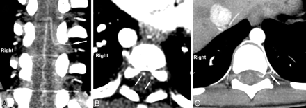 Fig 1.