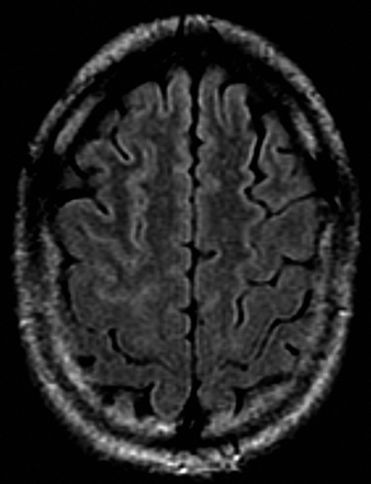 Fig 3.