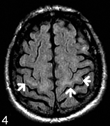 Fig 4.