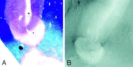 Fig 4.