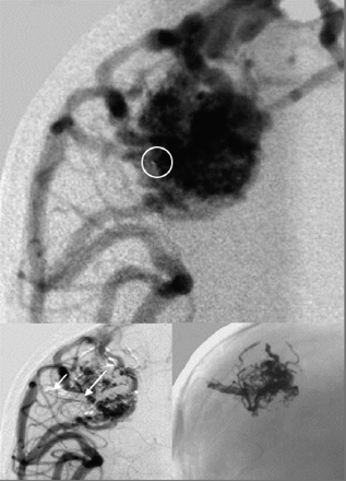 Fig 4.