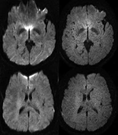 Fig 3.