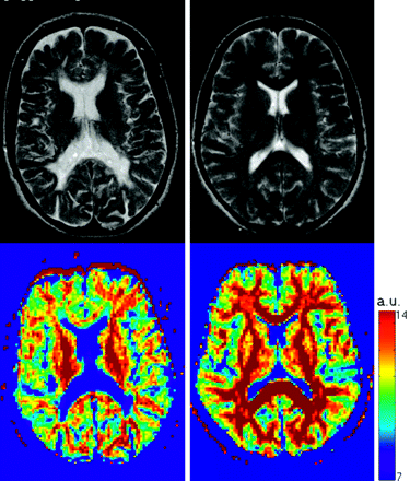 Fig 4.