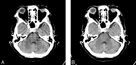 Fig 2.