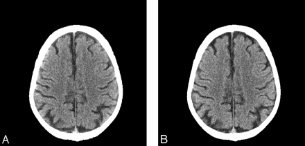 Fig 4.