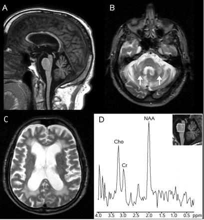 Fig 1.