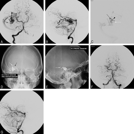Fig 1.