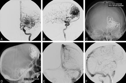 Fig 2.