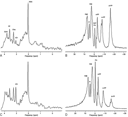 Fig 2.