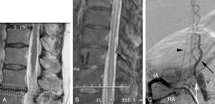   Fig 1. 
