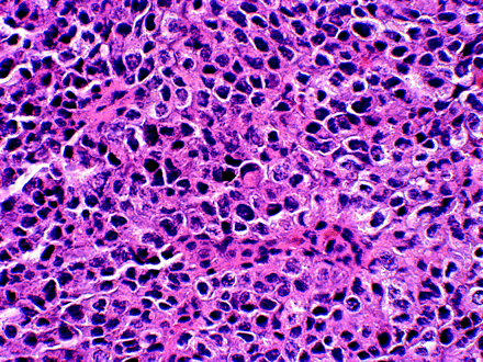 Fig 2.