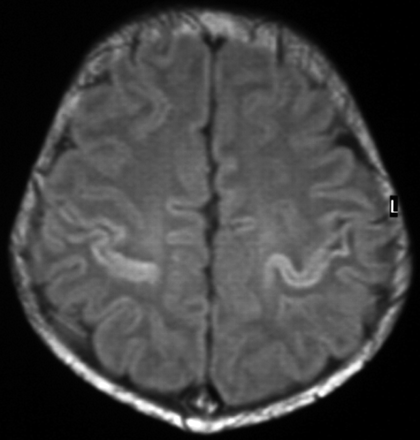 Fig 6.