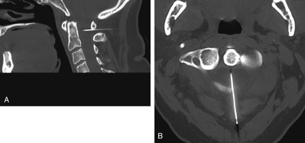 Fig 2.
