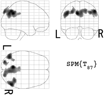 Fig 1.