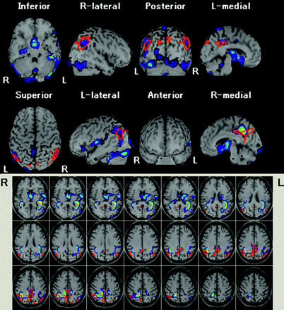 Fig 3.