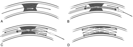 Fig 1.