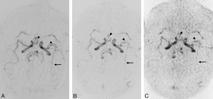Fig 2.