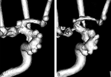 Fig 4.