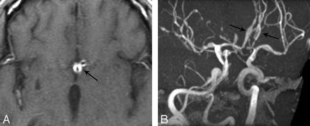  Fig 1. 