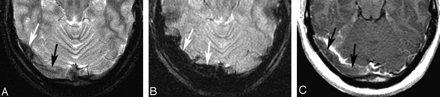 Fig 3.