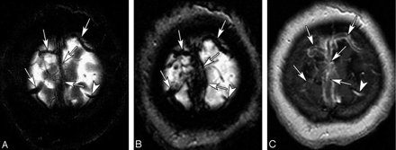 Fig 5.
