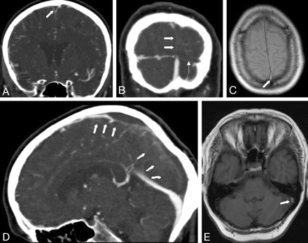 Fig 2.