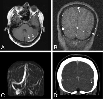 Fig 3.